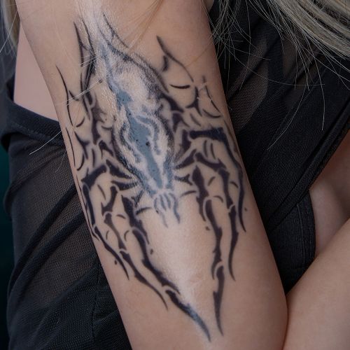 Arm